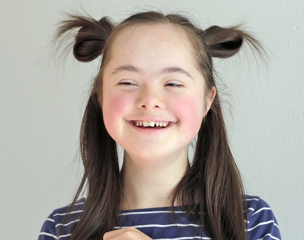 Young Disabled Girl Grinning